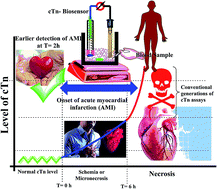 Graphical abstract: A novel, fast, high sensitivity biosensor for supporting therapeutic decisions and onset actions for chest pain cases