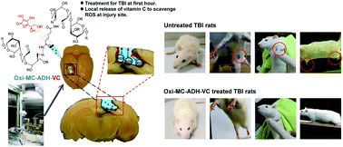 Graphical abstract: The preparation of oxidized methylcellulose crosslinked by adipic acid dihydrazide loaded with vitamin C for traumatic brain injury