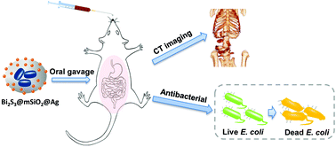 Graphical abstract: A Bi2S3@mSiO2@Ag nanocomposite for enhanced CT visualization and antibacterial response in the gastrointestinal tract