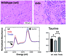 Graphical abstract: Investigation of the effect of taurine supplementation on muscle taurine content in the mdx mouse model of Duchenne muscular dystrophy using chemically specific synchrotron imaging
