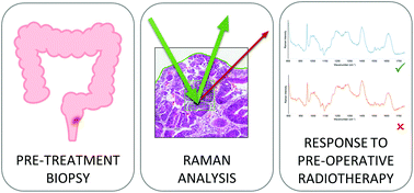 Graphical abstract: Developing a Raman spectroscopy-based tool to stratify patient response to pre-operative radiotherapy in rectal cancer