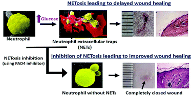 Graphical abstract: Modulating neutrophil extracellular traps for wound healing