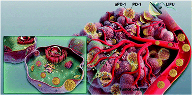 Graphical abstract: A low-intensity focused ultrasound-assisted nanocomposite for advanced triple cancer therapy: local chemotherapy, therapeutic extracellular vesicles and combined immunotherapy