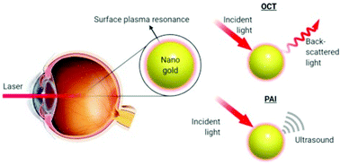 Graphical abstract: Gold nanoparticles to enhance ophthalmic imaging