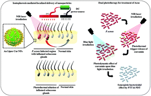 Graphical abstract: Iontophoresis mediated localized delivery of liposomal gold nanoparticles for photothermal and photodynamic therapy of acne