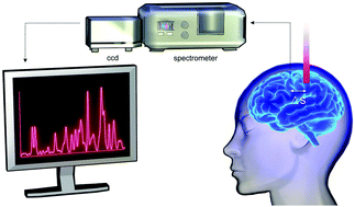 Graphical abstract: Spatially offset Raman spectroscopy for biomedical applications