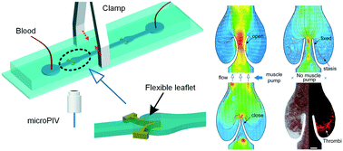 Graphical abstract: Effects of altered blood flow induced by the muscle pump on thrombosis in a microfluidic venous valve model