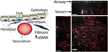 Graphical abstract: A 96-well format microvascularized human lung-on-a-chip platform for microphysiological modeling of fibrotic diseases