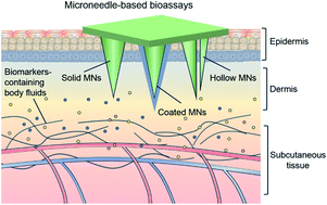 Graphical abstract: Microneedle-based bioassays