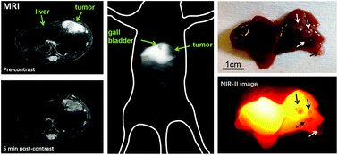 Graphical abstract: An NIR-II/MR dual modal nanoprobe for liver cancer imaging