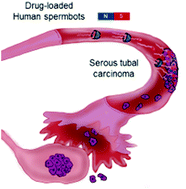 Graphical abstract: Human spermbots for patient-representative 3D ovarian cancer cell treatment
