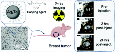 Graphical abstract: Silver telluride nanoparticles as biocompatible and enhanced contrast agents for X-ray imaging: an in vivo breast cancer screening study