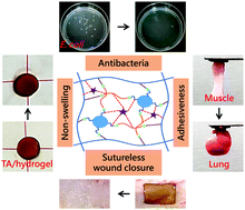 Graphical abstract: An anti-infective hydrogel adhesive with non-swelling and robust mechanical properties for sutureless wound closure