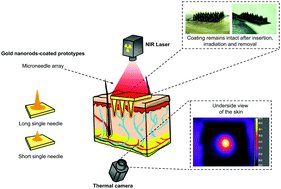 Graphical abstract: Plasmonic photothermal microneedle arrays and single needles for minimally-invasive deep in-skin hyperthermia