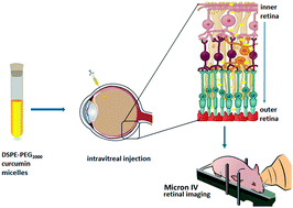 Graphical abstract: Non-invasive optical imaging of retinal Aβ plaques using curcumin loaded polymeric micelles in APPswe/PS1ΔE9 transgenic mice for the diagnosis of Alzheimer's disease
