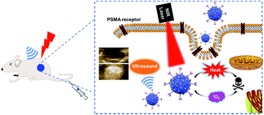 Graphical abstract: PSMA-targeted melanin-like nanoparticles as a multifunctional nanoplatform for prostate cancer theranostics