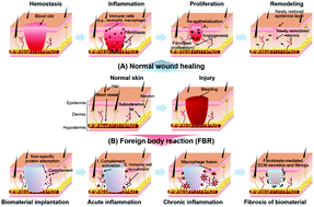 Graphical abstract: Advances in gelatin-based hydrogels for wound management