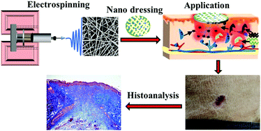 Graphical abstract: Exploration of the antibacterial and wound healing potential of a PLGA/silk fibroin based electrospun membrane loaded with zinc oxide nanoparticles