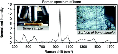 Graphical abstract: Compositional assessment of bone by Raman spectroscopy