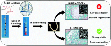 Graphical abstract: Injectable silanized hyaluronic acid hydrogel/biphasic calcium phosphate granule composites with improved handling and biodegradability promote bone regeneration in rabbits