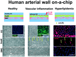 Graphical abstract: A novel human arterial wall-on-a-chip to study endothelial inflammation and vascular smooth muscle cell migration in early atherosclerosis