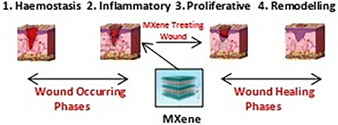 Graphical abstract: MXenes: promising 2D materials for wound dressing applications – a perspective review
