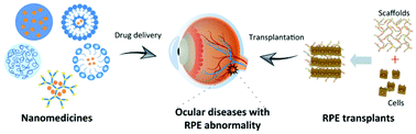 Graphical abstract: Therapeutic implications of nanodrug and tissue engineering for retinal pigment epithelium-related diseases