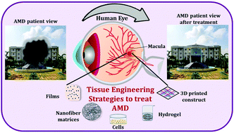 Graphical abstract: Tissue engineering approaches towards the regeneration of biomimetic scaffolds for age-related macular degeneration