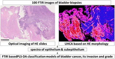 Graphical abstract: Evaluation of grade and invasiveness of bladder urothelial carcinoma using infrared imaging and machine learning