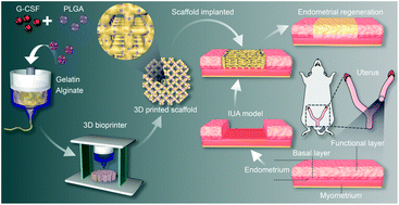 Graphical abstract: 3D-printed hydrogel scaffold-loaded granulocyte colony-stimulating factor sustained-release microspheres and their effect on endometrial regeneration