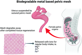 Graphical abstract: Design, mechanical and degradation requirements of biodegradable metal mesh for pelvic floor reconstruction
