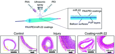 Graphical abstract: Mir-22-incorporated polyelectrolyte coating prevents intima hyperplasia after balloon-induced vascular injury