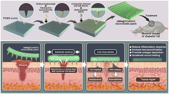 Graphical abstract: An antibacterial and proangiogenic double-layer drug-loaded microneedle patch for accelerating diabetic wound healing