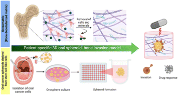 Graphical abstract: Osteomatrix as a personalized 3D tissue-specific invasion test-bed for oral carcinoma