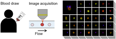Graphical abstract: Virtual-freezing fluorescence imaging flow cytometry with 5-aminolevulinic acid stimulation and antibody labeling for detecting all forms of circulating tumor cells