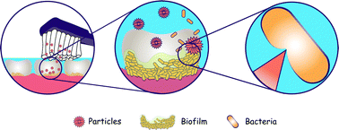 Graphical abstract: Mechano-bactericidal anisotropic particles for oral biofilm treatment