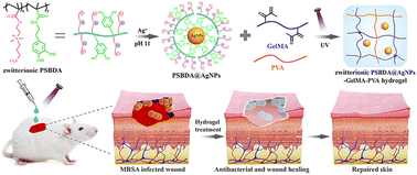 Graphical abstract: A zwitterionic silver nanoparticle-incorporating injectable hydrogel with a durable and efficient antibacterial effect for accelerated wound healing