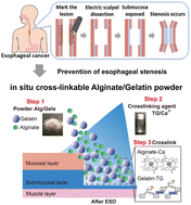 Graphical abstract: Prevention of esophageal stenosis via in situ cross-linkable alginate/gelatin powder in a new submucosal exfoliation model in rats