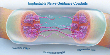 Graphical abstract: Beyond the limiting gap length: peripheral nerve regeneration through implantable nerve guidance conduits