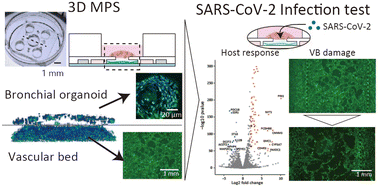 Graphical abstract: SARS-CoV-2-induced disruption of a vascular bed in a microphysiological system caused by type-I interferon from bronchial organoids