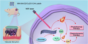 Graphical abstract: Nanozyme-integrated microneedle patch for enhanced therapy of cutaneous squamous cell carcinoma by breaking the gap between H2O2 self-supplying chemodynamic therapy and photothermal therapy