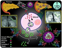 Graphical abstract: Mn(ii) complex impregnated porous silica nanoparticles as Zn(ii)-responsive “Smart” MRI contrast agent for pancreas imaging