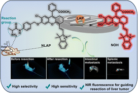 Graphical abstract: Engineering a near-infrared LAP fluorescent probe with high sensitivity and selectivity for surgical resection of liver cancer