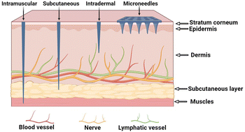 Graphical abstract: Unique advantages and applications of polysaccharide microneedles as drug delivery materials and in treatment of skin diseases