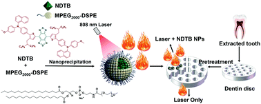 Graphical abstract: A dentin hypersensitivity treatment using highly stable photothermal conversion nanoparticles