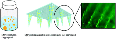 Graphical abstract: Nanoparticle-infused-biodegradable-microneedles as drug-delivery systems: preparation and characterisation