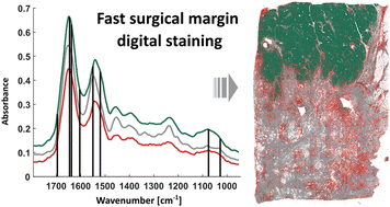 Graphical abstract: Fast cancer imaging in pancreatic biopsies using infrared imaging