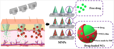 Graphical abstract: Personalized demand-responsive biphasic microneedle patch for smart drug administration