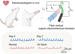 Graphical abstract: Fast-response fiber organic electrochemical transistor with vertical channel design for electrophysiological monitoring