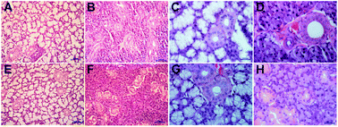 Graphical abstract: Monitoring the biochemical alterations in hypertension affected salivary gland tissues using Fourier transform infrared hyperspectral imaging